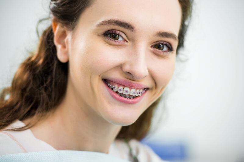 Traditional Braces Davie